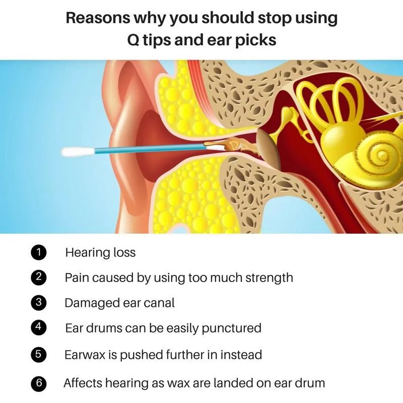 Shoppy Ear Wax Removal Kit